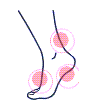 Foot Injuries